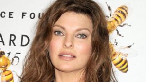 Supermodel Linda Evangelista deformisana nakon kozmetičke procedure