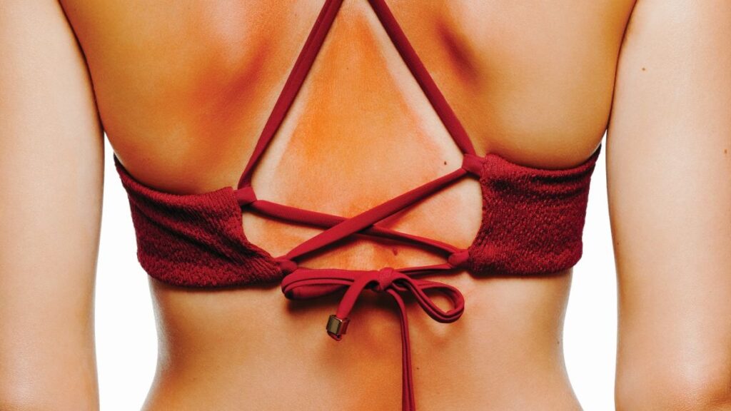 Vrelina leta Koža pamti sunce, a stil - osećaj