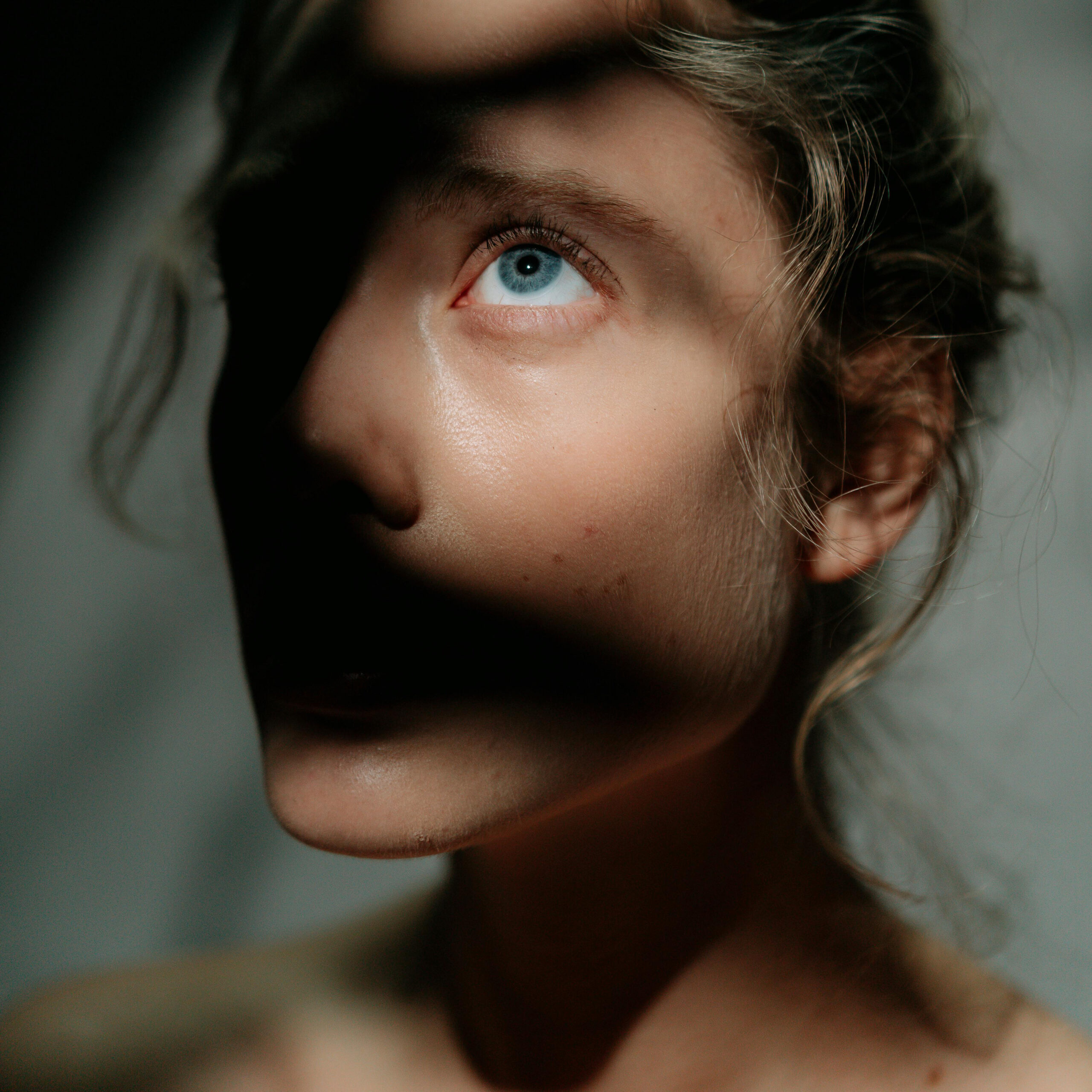 Šta je Rejuran i zašto postaje sve popularniji tretman za podočnjake